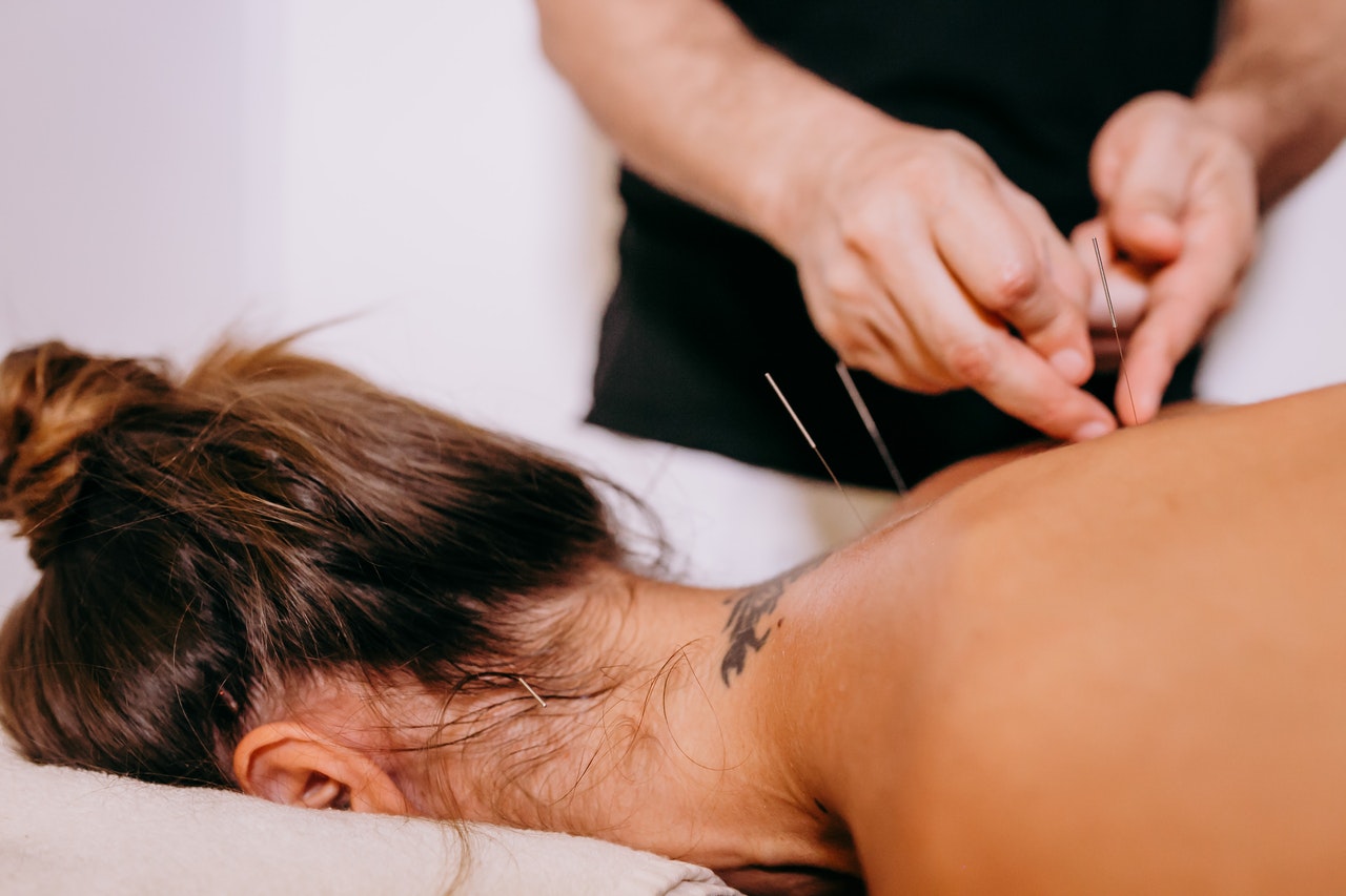 Pricing for Acupuncture