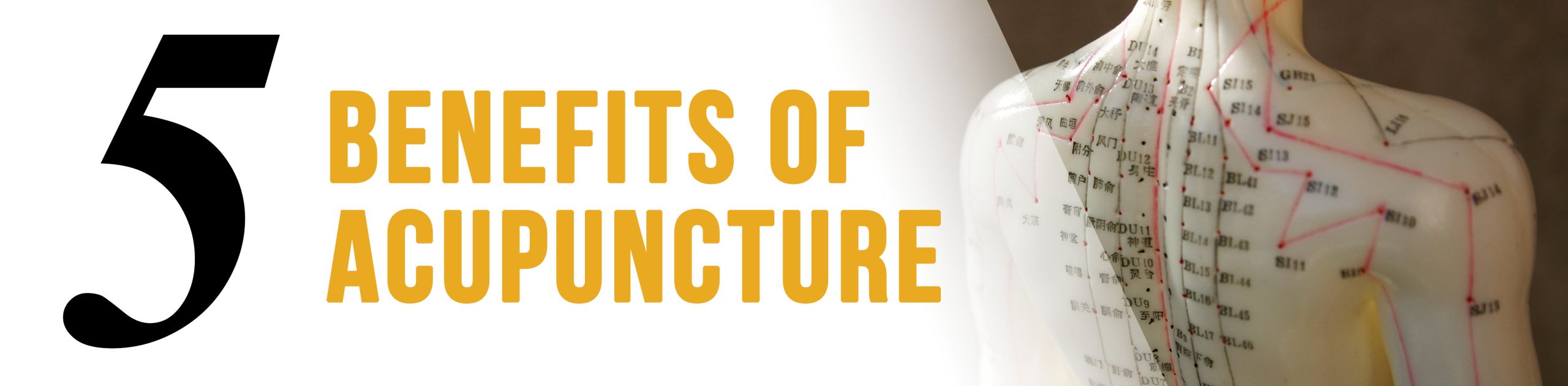 5 Benefits of Acupuncture Care